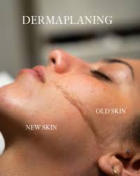 Express Dermaplane Session